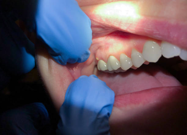 Best Urgent Tooth Repair  in Fowlkes, TN